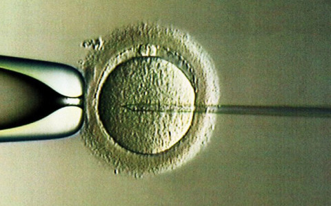 Fecondazione in vitro: il prelievo degli spermatozoi dai testicoli